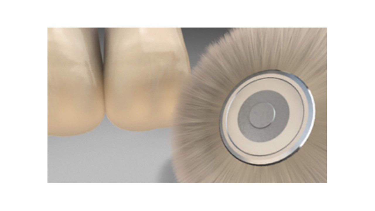 Veneer Kompozit Aksesuarları