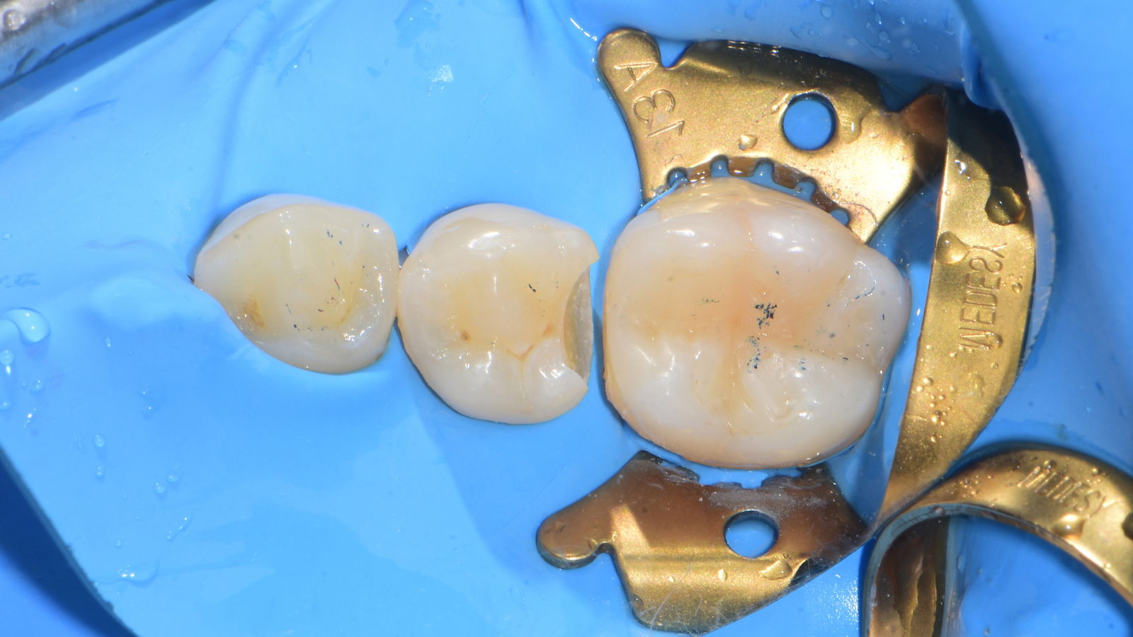 Click and hold the green slider. Move from side to side to reveal the before-and-after pictures.