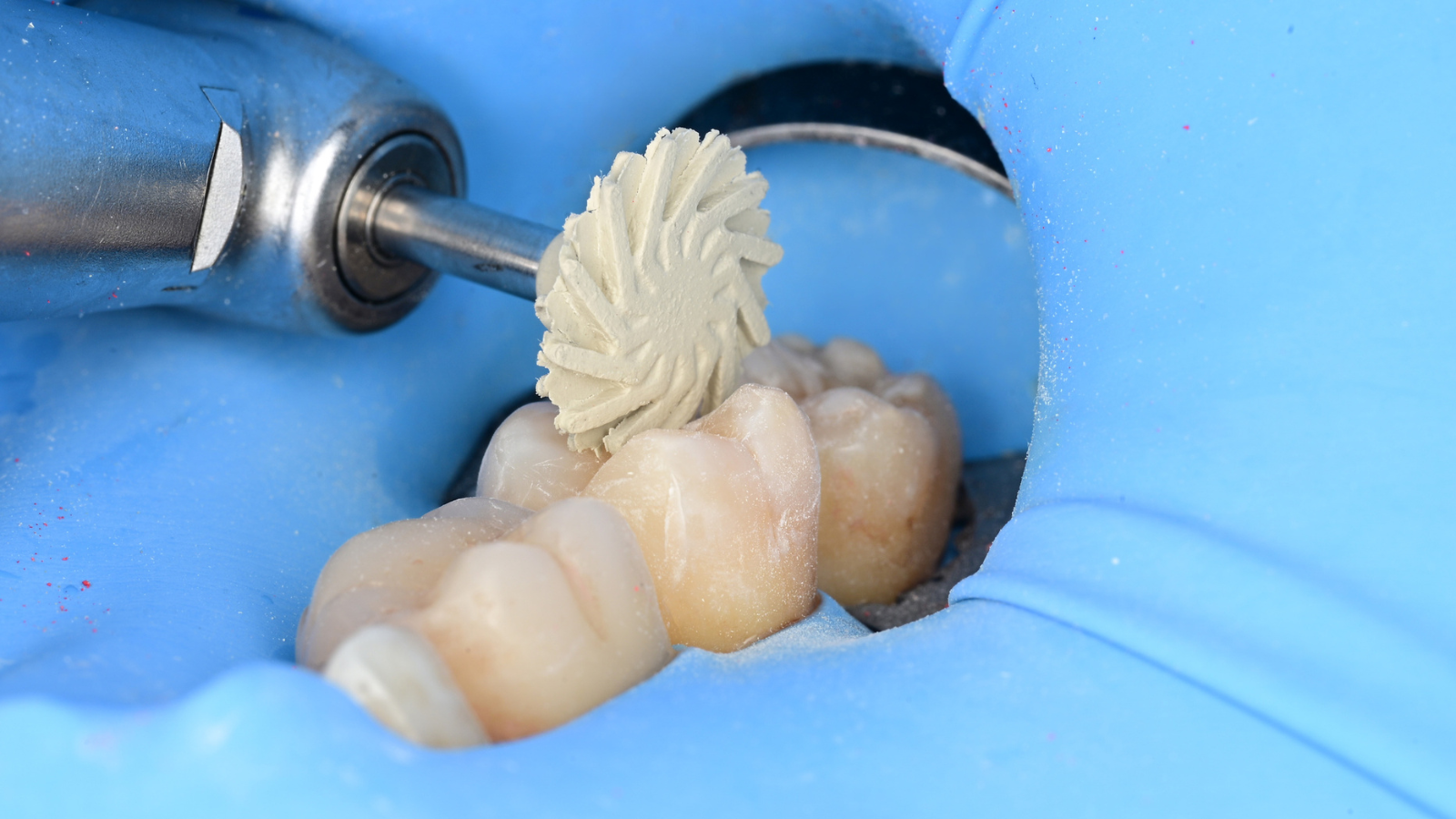 Occlusal