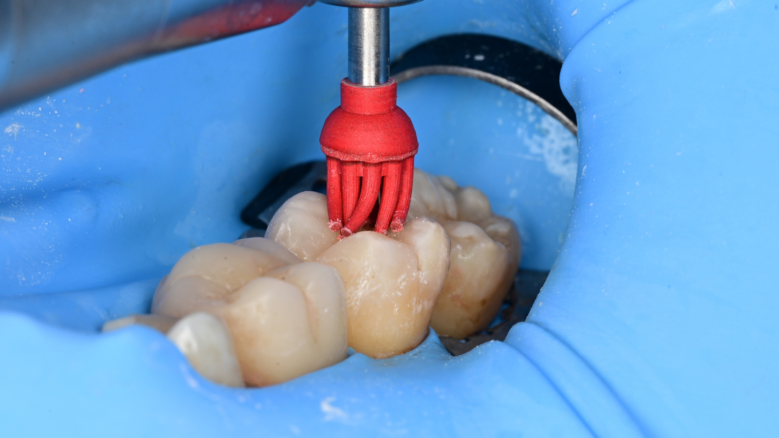 Twist Brush pre-polisher