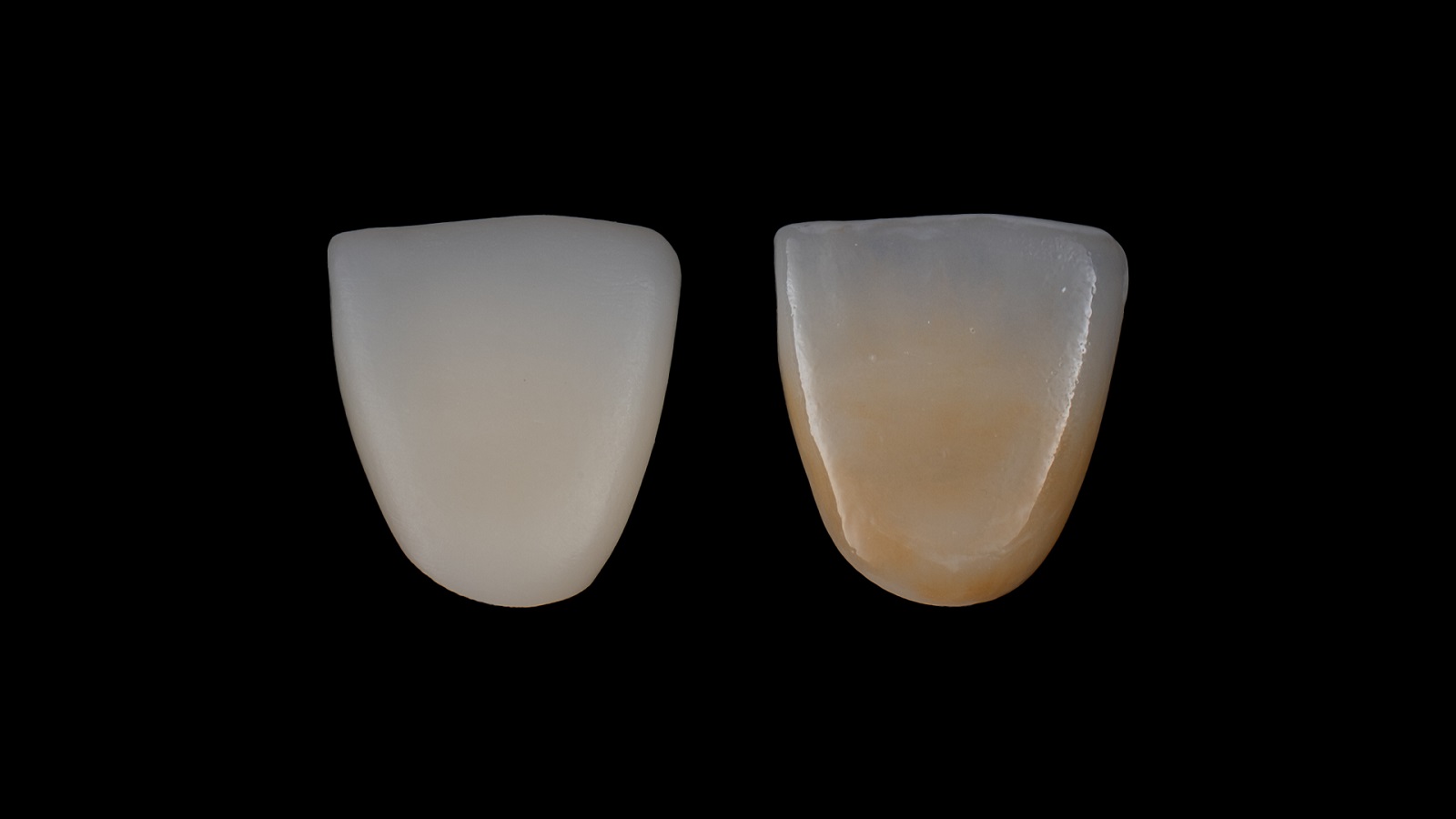 Kroma ve translusensinin kolay adaptasyonu