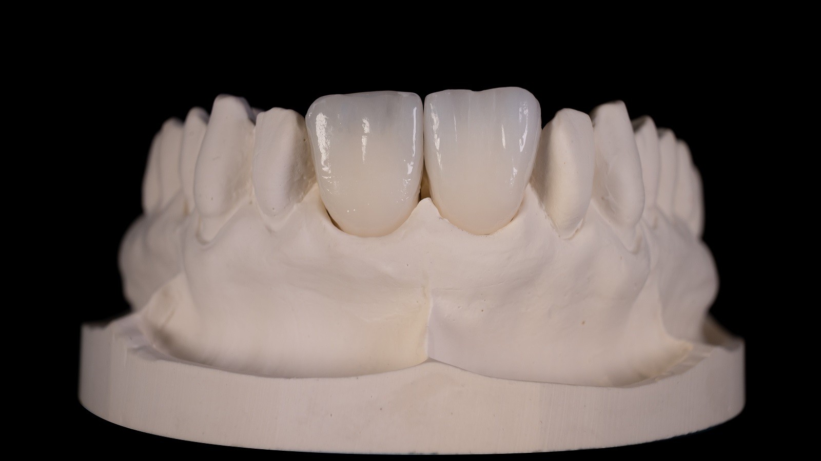 Final result after HeraCeram cre-active 2D firing