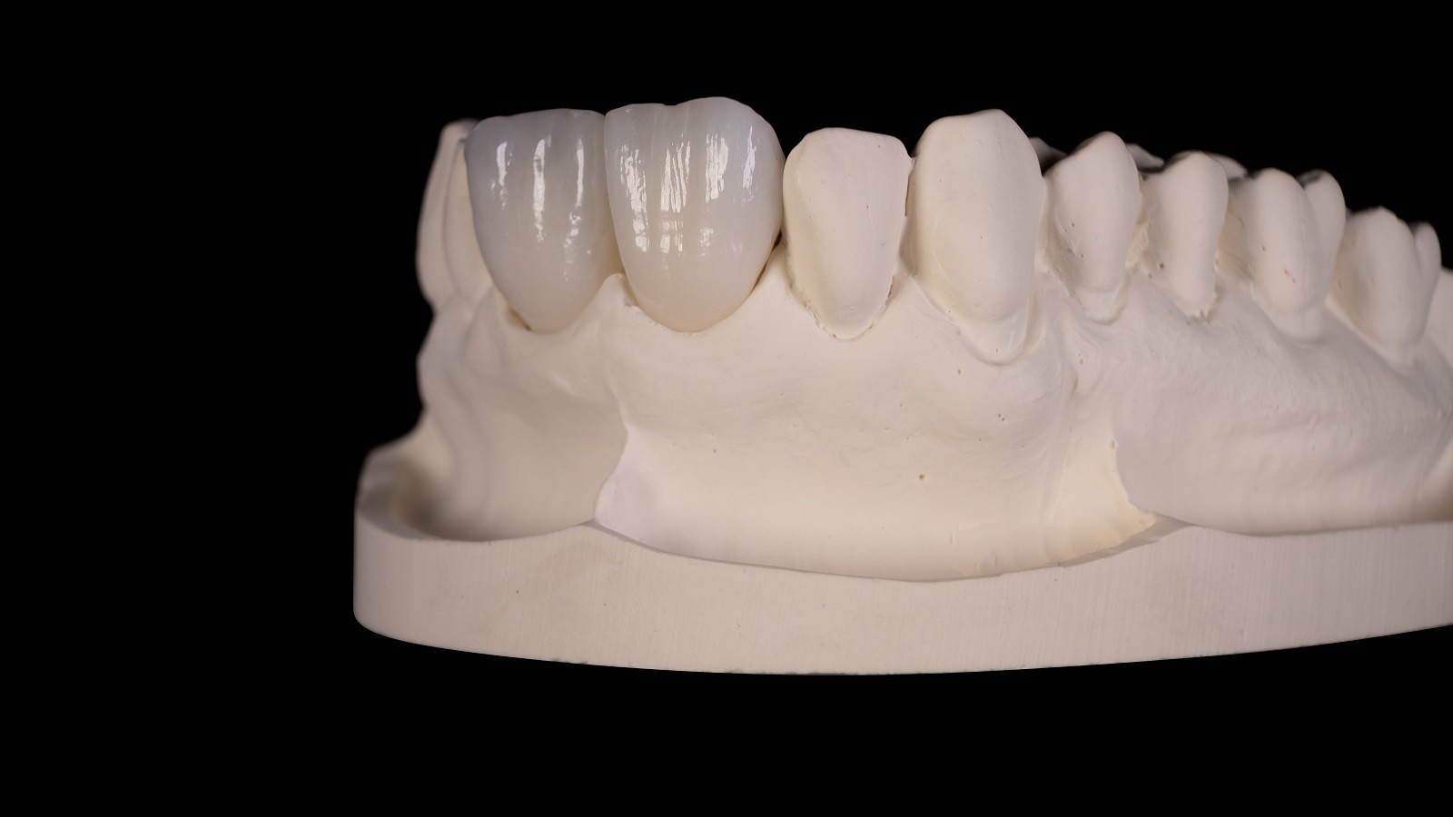Final result after HeraCeram cre-active 2D firing