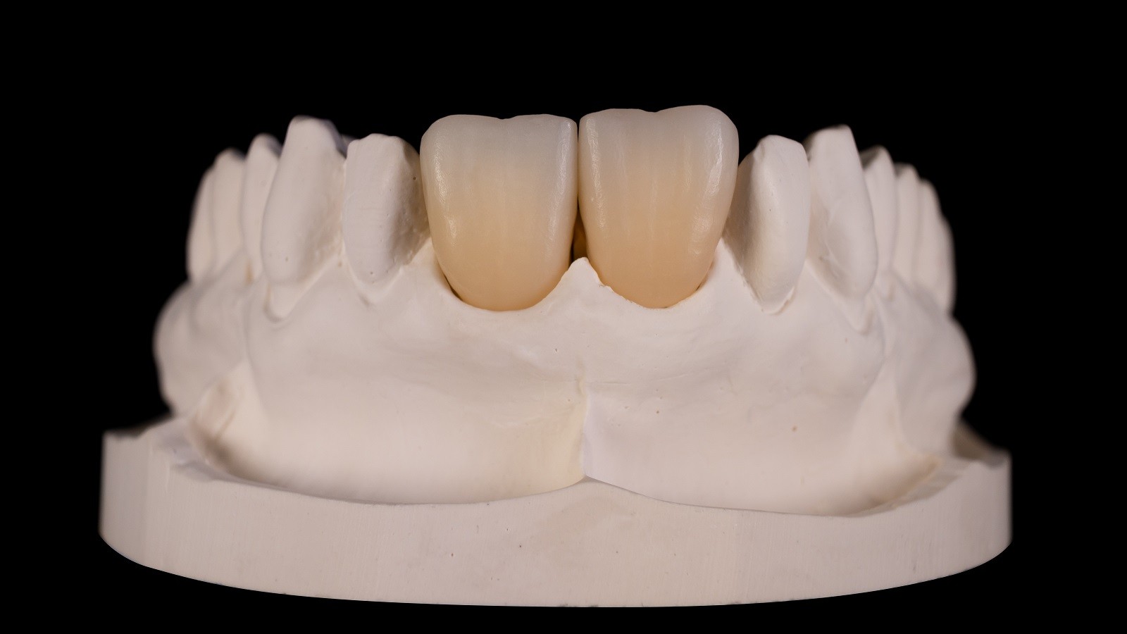 Zirconia multi-layer frames - ready for individualisation 