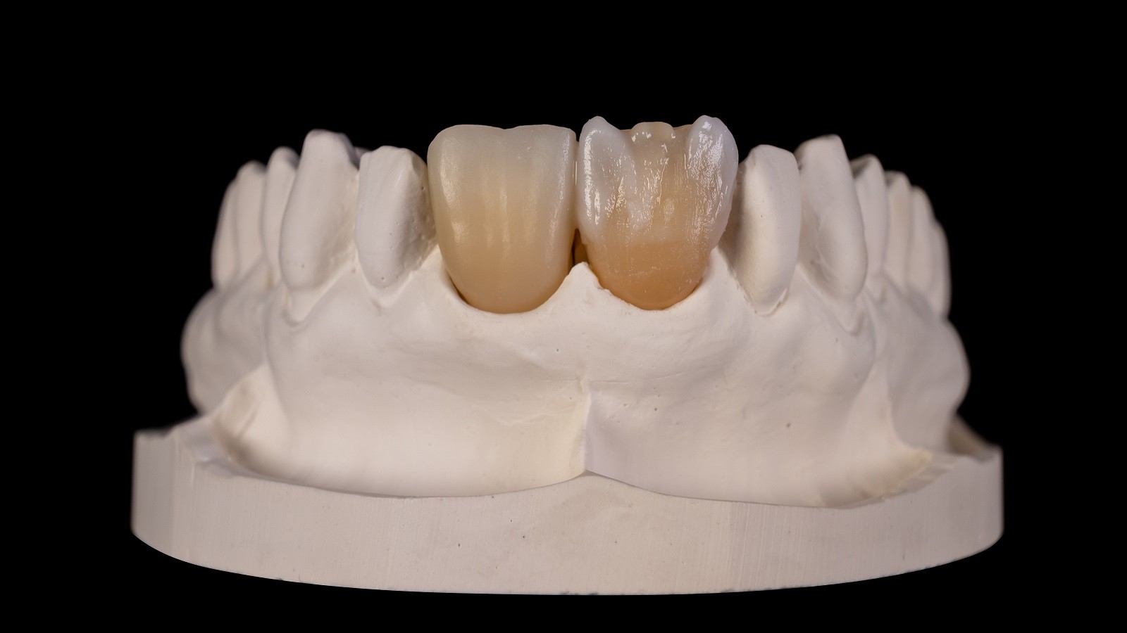 HeraCeram cre-active - Magic matrix concept