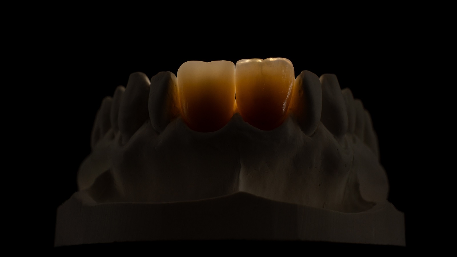 Geçirgen ışık altında görünüm.