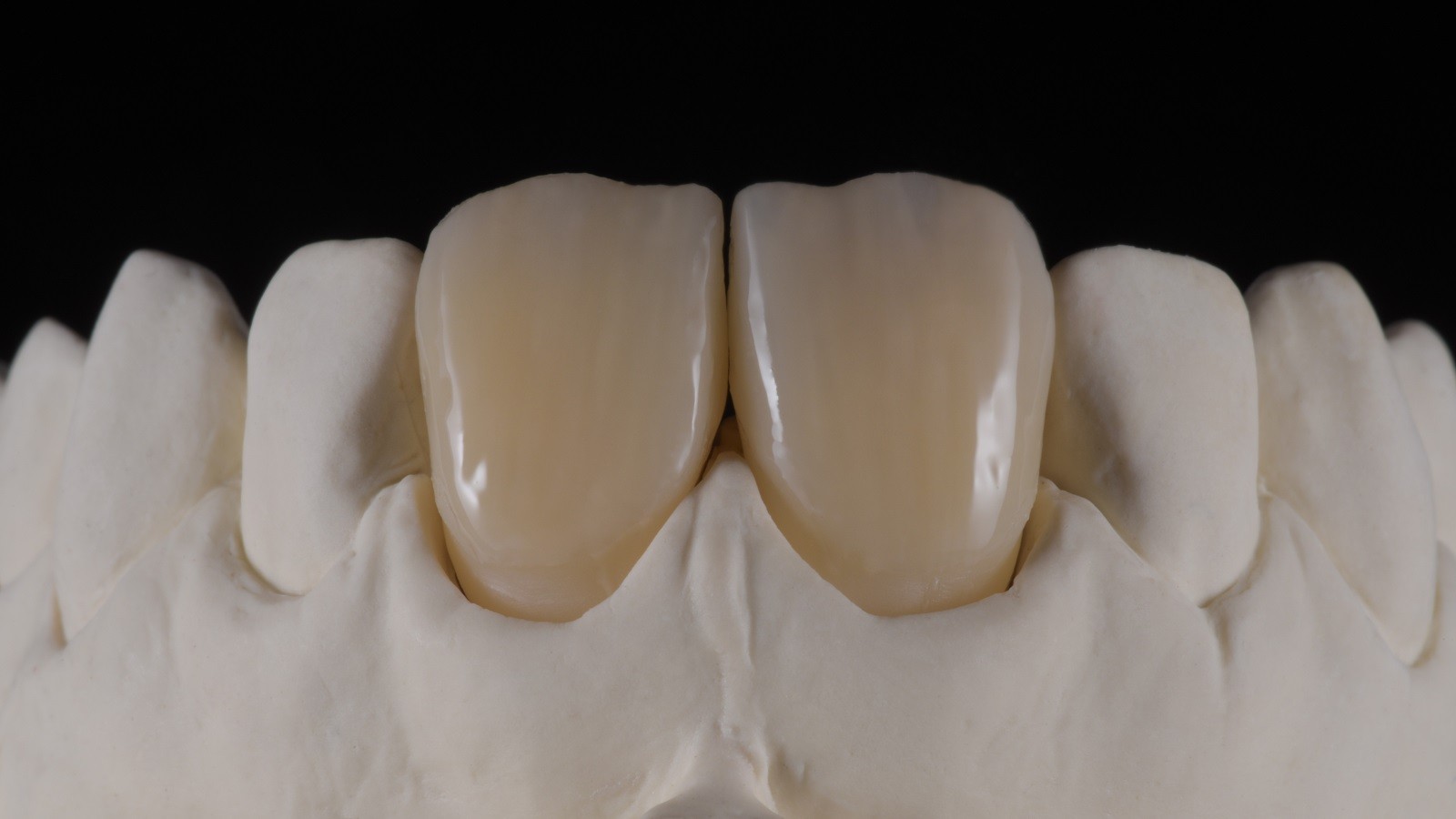 HeraCeram cre-active - take two concept