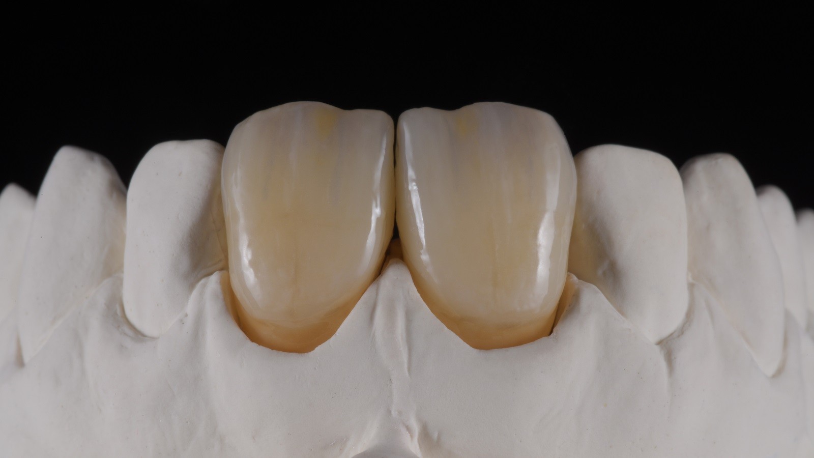 HeraCeram cre-active - take two concept