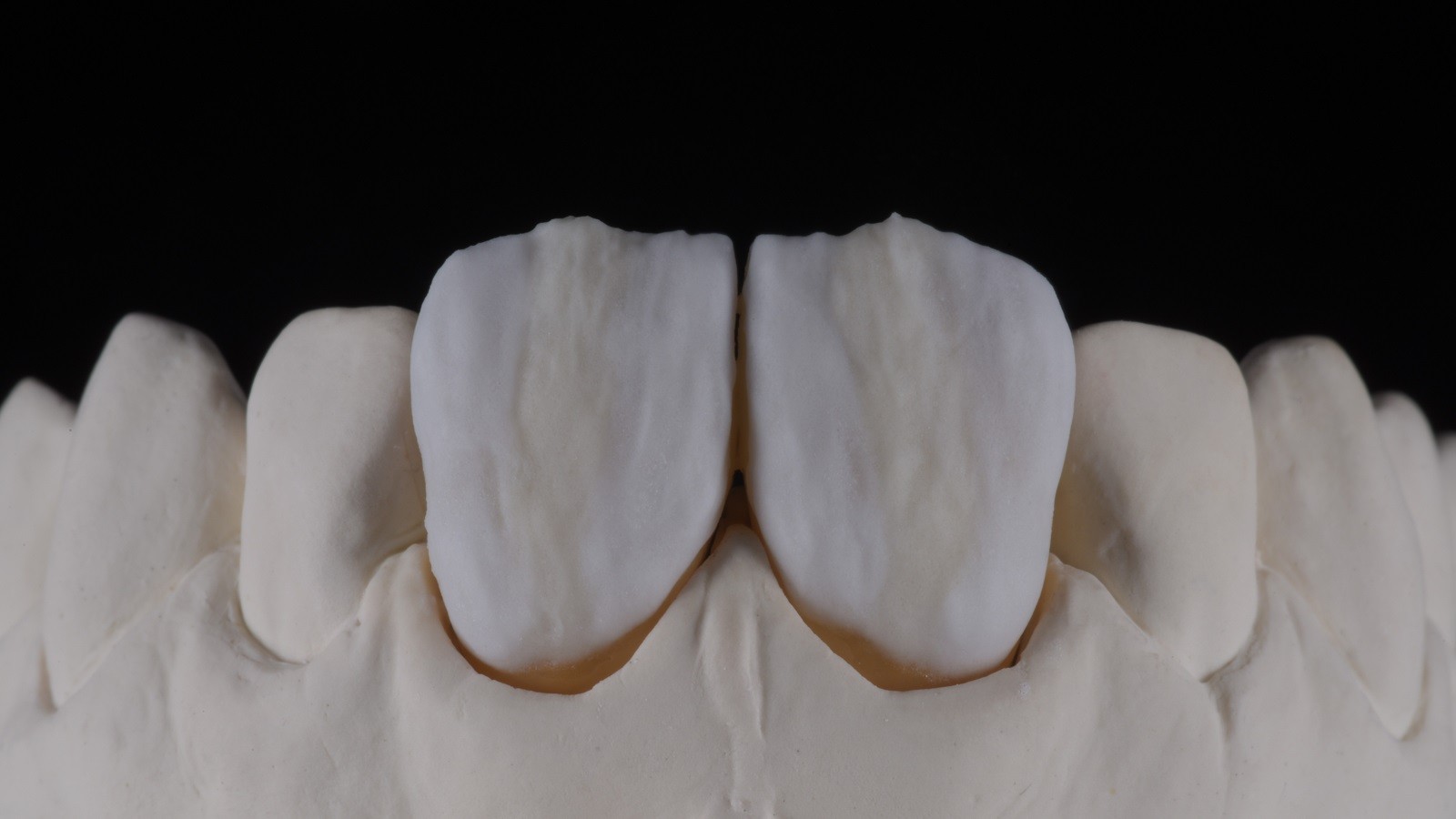 HeraCeram cre-active - take two concept