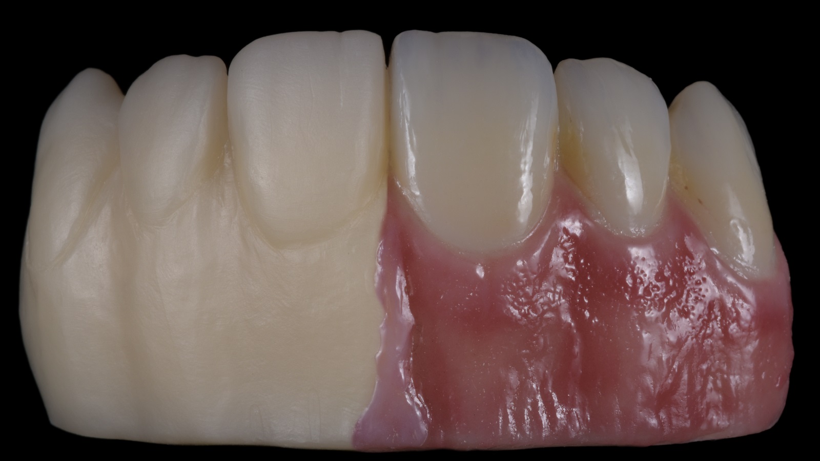 Öncesi-sonrası vaka