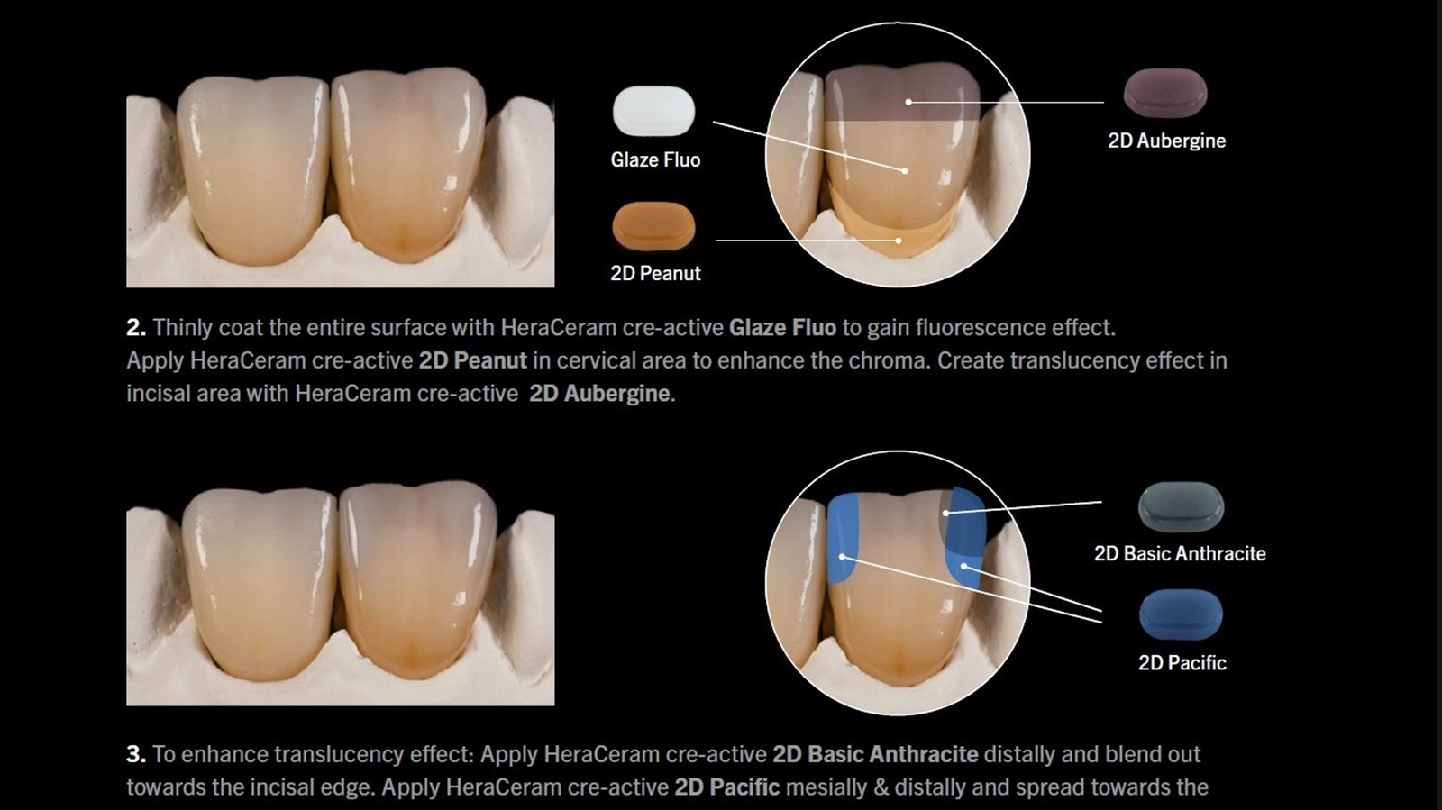 Standard Staining concept